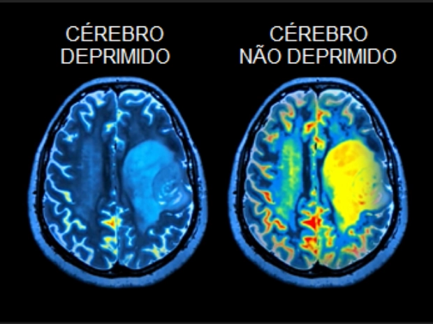 Tratamentos Dicas E Ajuda Com A Sa de Mental Medley tratamentos-dicas-e-ajuda-com-a-sa-de-mental-medley